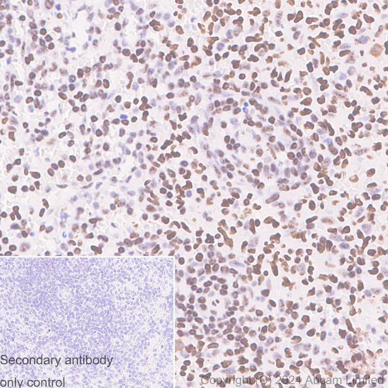 Immunohistochemistry (Formalin/PFA-fixed paraffin-embedded sections) - Anti-FOXP1 antibody [RM1113] - BSA and Azide free (AB320746)