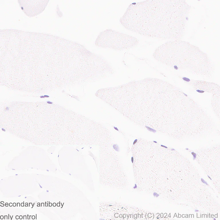Immunohistochemistry (Formalin/PFA-fixed paraffin-embedded sections) - Anti-FOXP1 antibody [RM1113] - BSA and Azide free (AB320746)