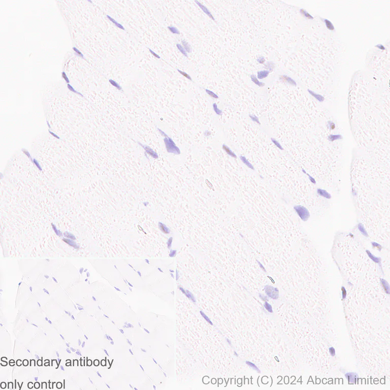 Immunohistochemistry (Formalin/PFA-fixed paraffin-embedded sections) - Anti-FOXP1 antibody [RM1113] - BSA and Azide free (AB320746)