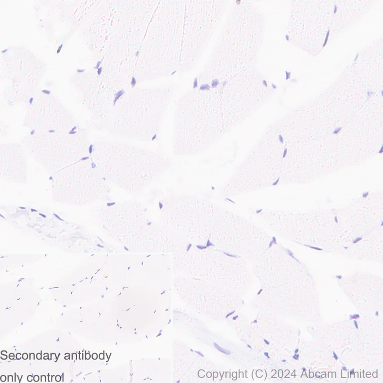 Immunohistochemistry (Formalin/PFA-fixed paraffin-embedded sections) - Anti-FOXP1 antibody [RM1113] - BSA and Azide free (AB320746)