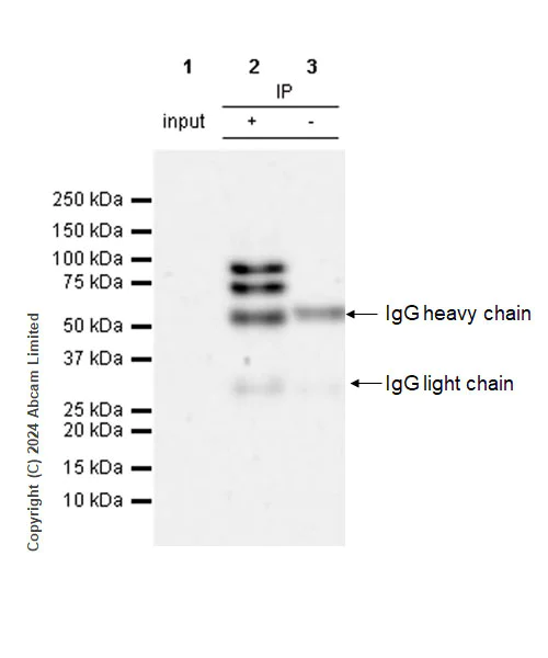 Immunoprecipitation - Anti-FOXP1 antibody [RM1113] - BSA and Azide free (AB320746)
