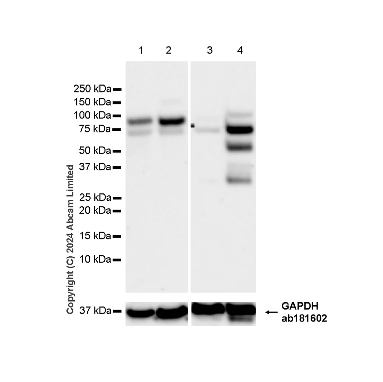 Western blot - Anti-FOXP1 antibody [RM1113] - BSA and Azide free (AB320746)