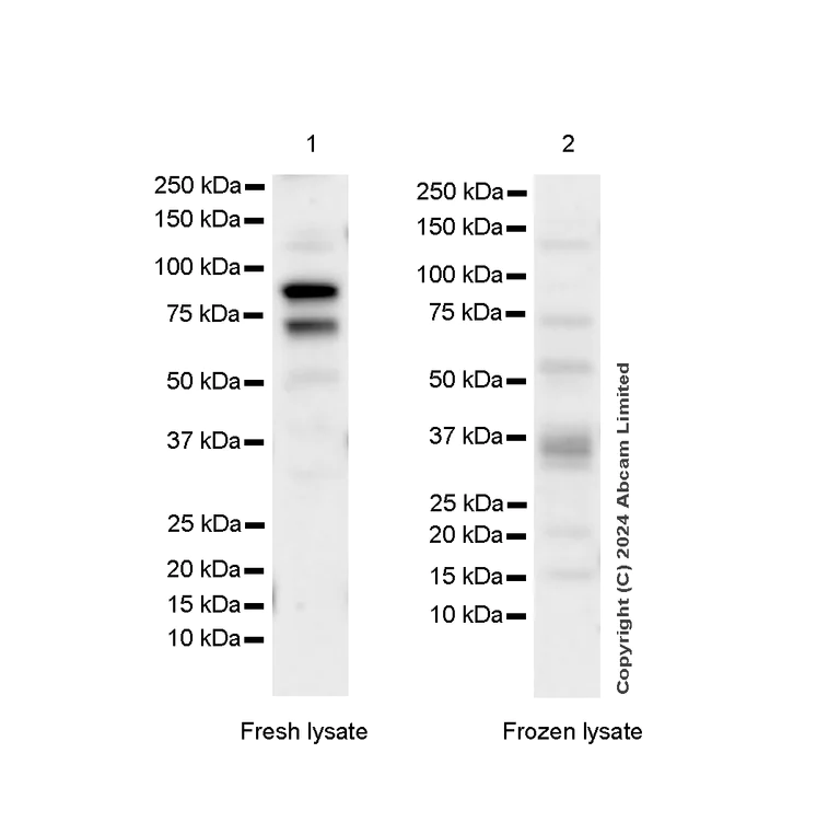Western blot - Anti-FOXP1 antibody [RM1113] - BSA and Azide free (AB320746)