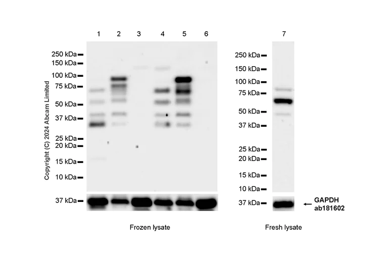 Western blot - Anti-FOXP1 antibody [RM1113] - BSA and Azide free (AB320746)