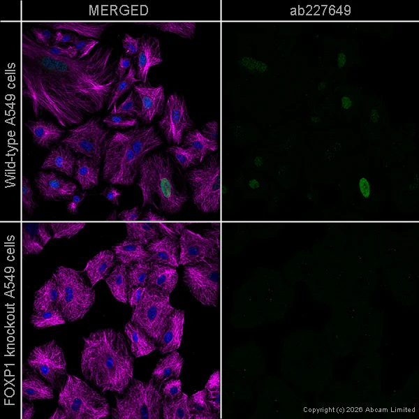 Immunocytochemistry/ Immunofluorescence - Anti-FOXP1 antibody [SP133] - BSA and Azide free (AB245739)