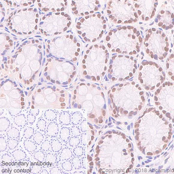 Immunohistochemistry (Formalin/PFA-fixed paraffin-embedded sections) - Anti-FOXP1 antibody [SP133] - BSA and Azide free (AB245739)