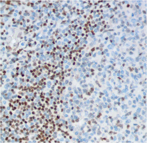 Immunohistochemistry (Formalin/PFA-fixed paraffin-embedded sections) - Anti-FOXP1 antibody [SP133] - BSA and Azide free (AB245739)