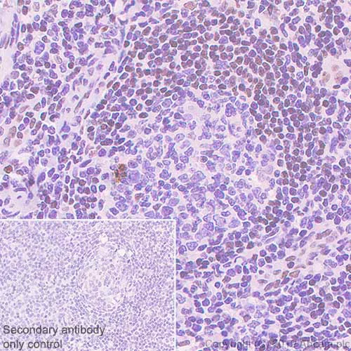 Immunohistochemistry (Formalin/PFA-fixed paraffin-embedded sections) - Anti-FOXP1 antibody [SP133] - BSA and Azide free (AB245739)