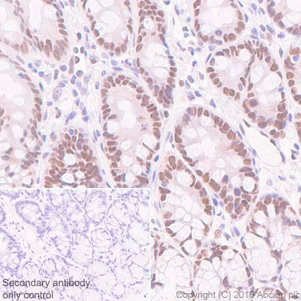 Immunohistochemistry (Formalin/PFA-fixed paraffin-embedded sections) - Anti-FOXP1 antibody [SP133] - BSA and Azide free (AB245739)