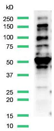 Western blot - Anti-FOXP1 antibody [SP133] - C-terminal (AB227649)