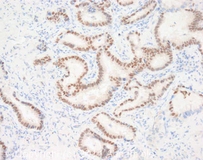 Immunohistochemistry (Formalin/PFA-fixed paraffin-embedded sections) - Anti-FOXP2 antibody [73A/8] (AB172320)