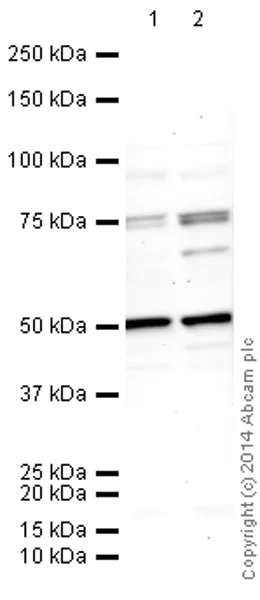 Western blot - Anti-FOXP2 antibody [73A/8] (AB172320)