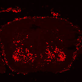 Immunocytochemistry/ Immunofluorescence - Anti-FOXP2 antibody (AB16046), expandable thumbnail