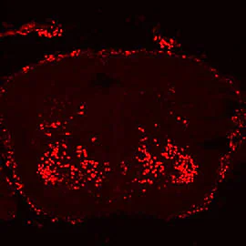 Immunocytochemistry/ Immunofluorescence - Anti-FOXP2 antibody (AB16046)