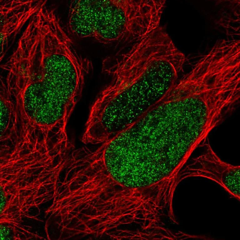 Immunocytochemistry/ Immunofluorescence - Anti-FOXP2 Antibody (AB327169)