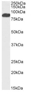 Western blot - Anti-FOXP2 antibody - C-terminal (AB1307)