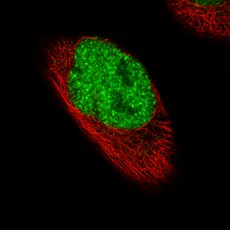Immunocytochemistry/ Immunofluorescence - Anti-FOXP2 antibody [CL5312] (AB243038), expandable thumbnail