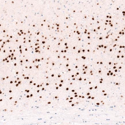 Immunohistochemistry (Formalin/PFA-fixed paraffin-embedded sections) - Anti-FOXP2 antibody [CL5312] (AB243038), expandable thumbnail