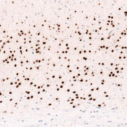 Immunohistochemistry (Formalin/PFA-fixed paraffin-embedded sections) - Anti-FOXP2 antibody [CL5312] (AB243038)