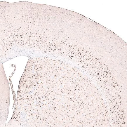 Immunohistochemistry (Formalin/PFA-fixed paraffin-embedded sections) - Anti-FOXP2 antibody [CL5312] (AB243038)