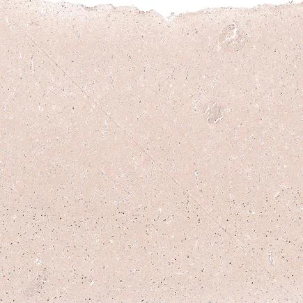 Immunohistochemistry (Formalin/PFA-fixed paraffin-embedded sections) - Anti-FOXP2 antibody [CL5312] (AB243038)