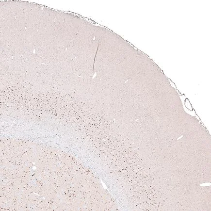 Immunohistochemistry (Formalin/PFA-fixed paraffin-embedded sections) - Anti-FOXP2 antibody [CL5312] (AB243038)