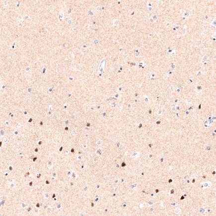 Immunohistochemistry (Formalin/PFA-fixed paraffin-embedded sections) - Anti-FOXP2 antibody [CL5312] (ab243038), expandable thumbnail