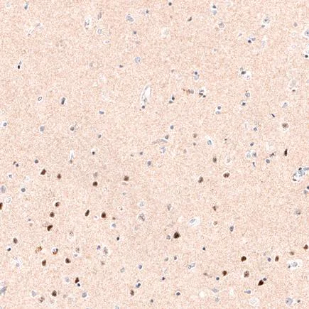 Immunohistochemistry (Formalin/PFA-fixed paraffin-embedded sections) - Anti-FOXP2 antibody [CL5312] (AB243038)