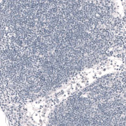 Immunohistochemistry (Formalin/PFA-fixed paraffin-embedded sections) - Anti-FOXP2 antibody [CL5312] (AB243038)