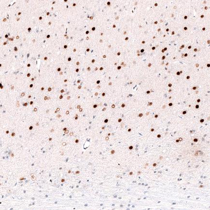 Immunohistochemistry (Formalin/PFA-fixed paraffin-embedded sections) - Anti-FOXP2 antibody [CL5312] (ab243038), expandable thumbnail