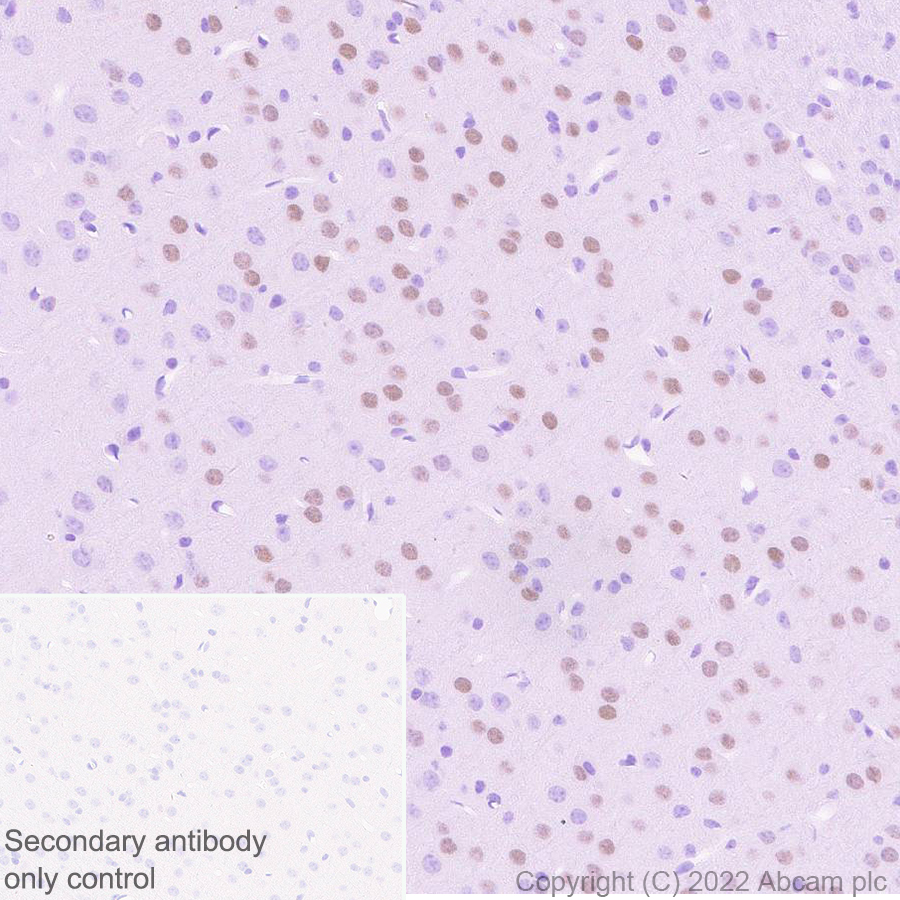 Immunohistochemistry (Formalin/PFA-fixed paraffin-embedded sections) - Anti-FOXP2 antibody [EPR27323-26] - BSA and Azide free (ab307506), expandable thumbnail