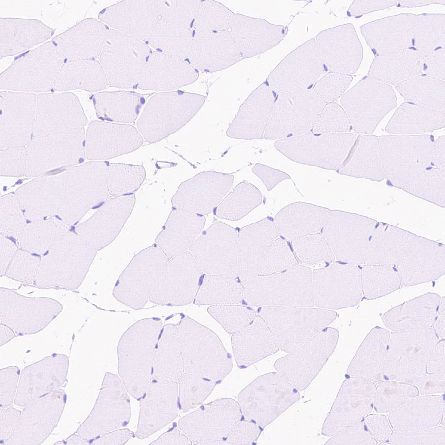 Immunohistochemistry (Formalin/PFA-fixed paraffin-embedded sections) - Anti-FOXP2 antibody [EPR27323-26] - BSA and Azide free (AB307506), expandable thumbnail