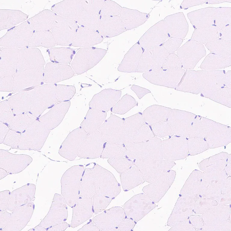 Immunohistochemistry (Formalin/PFA-fixed paraffin-embedded sections) - Anti-FOXP2 antibody [EPR27323-26] - BSA and Azide free (AB307506)
