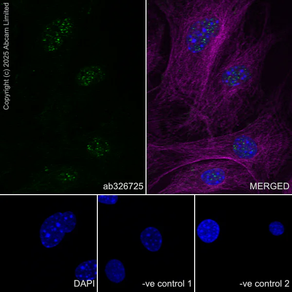 Immunocytochemistry/ Immunofluorescence - Anti-FOXP2 antibody [EPR29629-38] (AB326725)