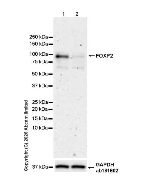 Western blot - Anti-FOXP2 antibody [EPR29629-38] - BSA and Azide free (AB326729)