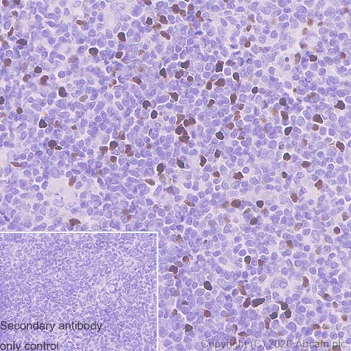 Immunohistochemistry (Formalin/PFA-fixed paraffin-embedded sections) - Anti-FOXP3 antibody [221D] (AB253297)
