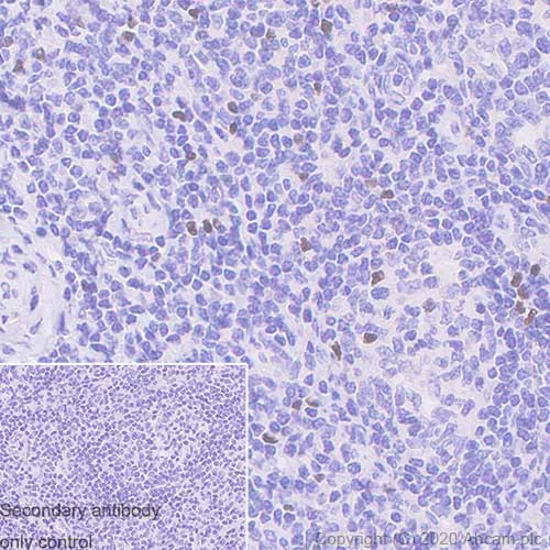 Immunohistochemistry (Formalin/PFA-fixed paraffin-embedded sections) - Anti-FOXP3 antibody [221D] (AB253297)