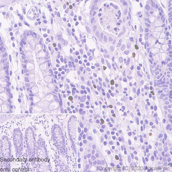 Immunohistochemistry (Formalin/PFA-fixed paraffin-embedded sections) - Anti-FOXP3 antibody [221D] (AB253297)