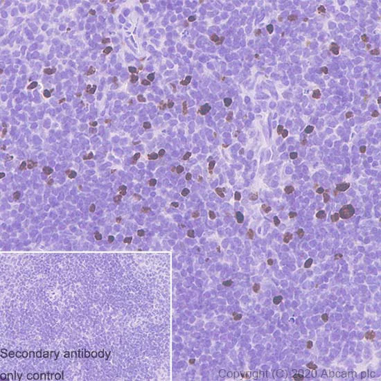 Immunohistochemistry (Formalin/PFA-fixed paraffin-embedded sections) - Anti-FOXP3 antibody [221D] (AB253297)