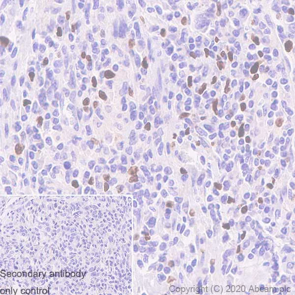 Immunohistochemistry (Formalin/PFA-fixed paraffin-embedded sections) - Anti-FOXP3 antibody [221D] - BSA and Azide free (AB255942)
