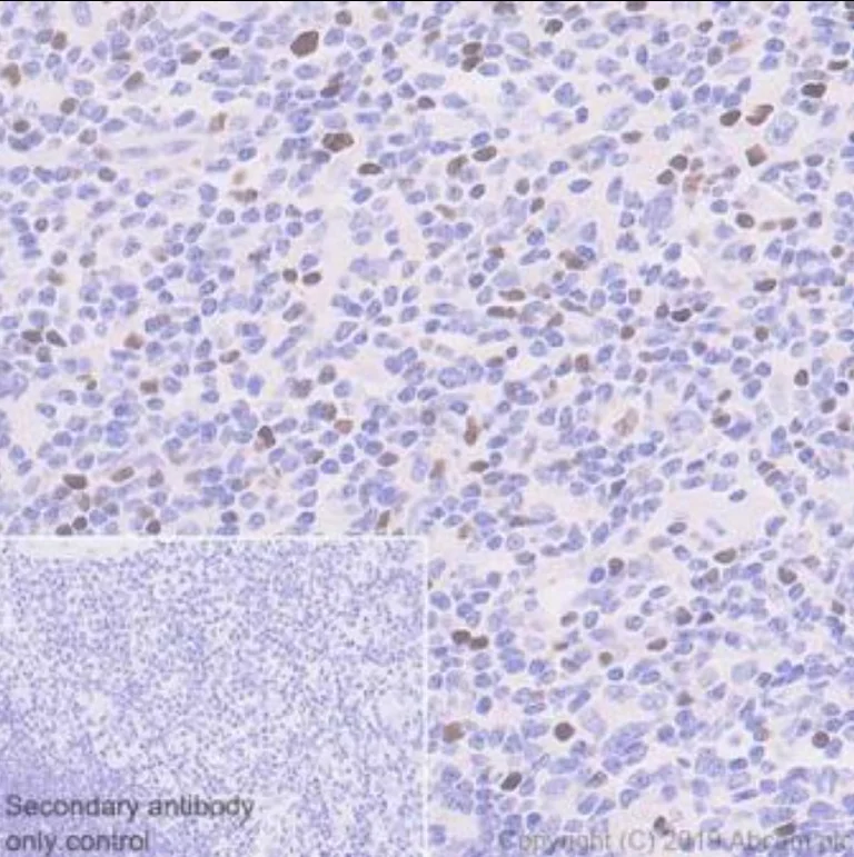 Immunohistochemistry (Formalin/PFA-fixed paraffin-embedded sections) - Anti-FOXP3 antibody [236A/E7] (AB20034)