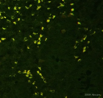 Immunohistochemistry (Formalin/PFA-fixed paraffin-embedded sections) - Anti-FOXP3 antibody [236A/E7] (AB20034)