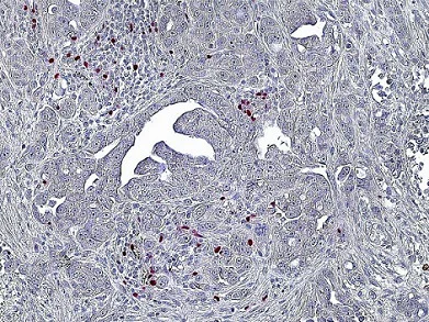 Immunohistochemistry (Formalin/PFA-fixed paraffin-embedded sections) - Anti-FOXP3 antibody [236A/E7] (AB20034)