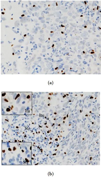 Immunohistochemistry (Formalin/PFA-fixed paraffin-embedded sections) - Anti-FOXP3 antibody [236A/E7] (AB20034)