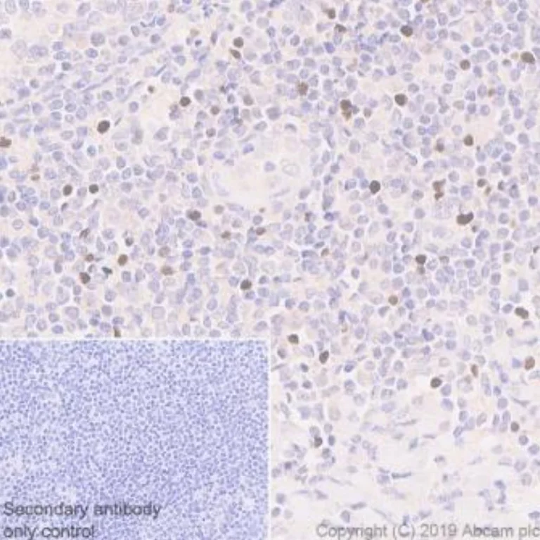 Immunohistochemistry (Formalin/PFA-fixed paraffin-embedded sections) - Anti-FOXP3 antibody [236A/E7] (AB20034)