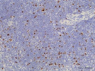 Immunohistochemistry (Formalin/PFA-fixed paraffin-embedded sections) - Anti-FOXP3 antibody [236A/E7] (AB20034)