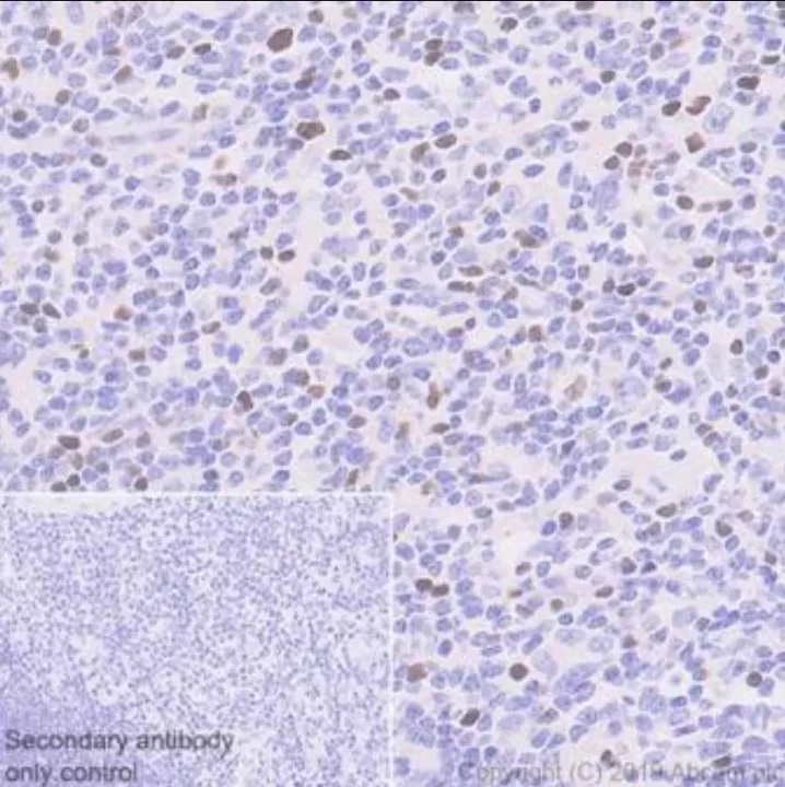 Immunohistochemistry (Formalin/PFA-fixed paraffin-embedded sections) - Anti-FOXP3 antibody [236A/E7] - BSA and Azide free (AB96048)