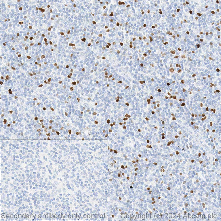 Immunohistochemistry (Formalin/PFA-fixed paraffin-embedded sections) - Anti-FOXP3 antibody [236A/E7] - BSA and Azide free (AB96048)
