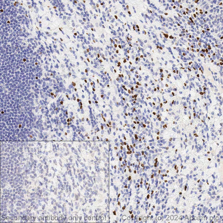Immunohistochemistry (Formalin/PFA-fixed paraffin-embedded sections) - Anti-FOXP3 antibody [236A/E7] - BSA and Azide free (AB96048)