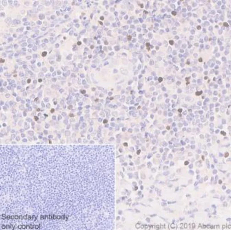 Immunohistochemistry (Formalin/PFA-fixed paraffin-embedded sections) - Anti-FOXP3 antibody [236A/E7] - BSA and Azide free (AB96048)